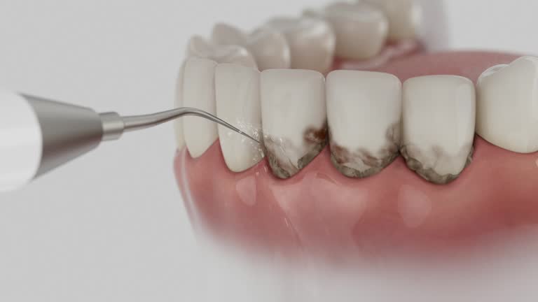 Trusted Dental Crowns And Bridges service in Gueydan, LA - Dentist Open Now